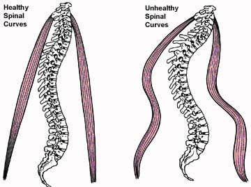 Ribbon spinal curves