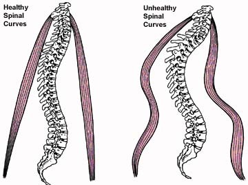 Ribbon spinal curves